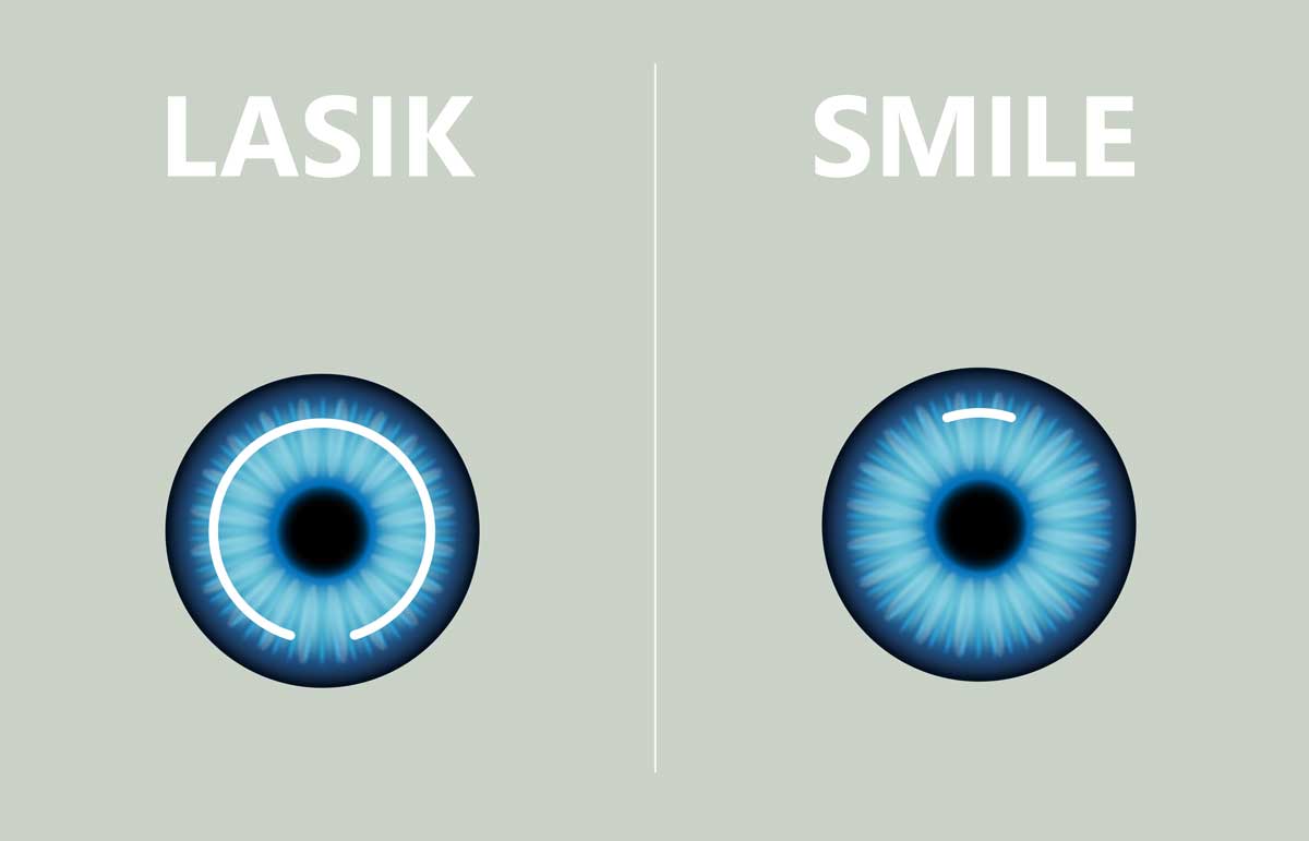 Smile Lazer